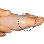Protetor para Joanete com Alça Siligel 4011 X